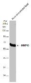Anti-MMP19 antibody used in Western Blot (WB). GTX108931